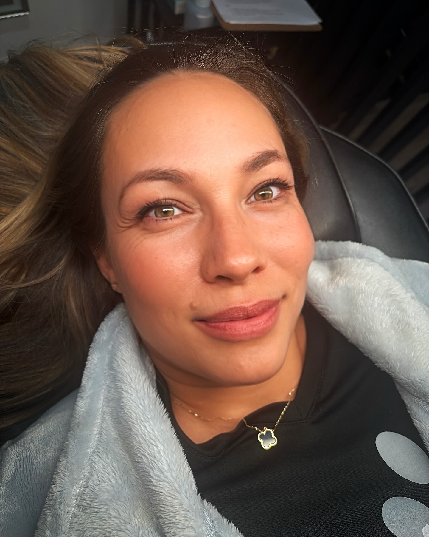 Dermaplaning