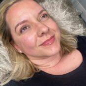 Chemical Peel