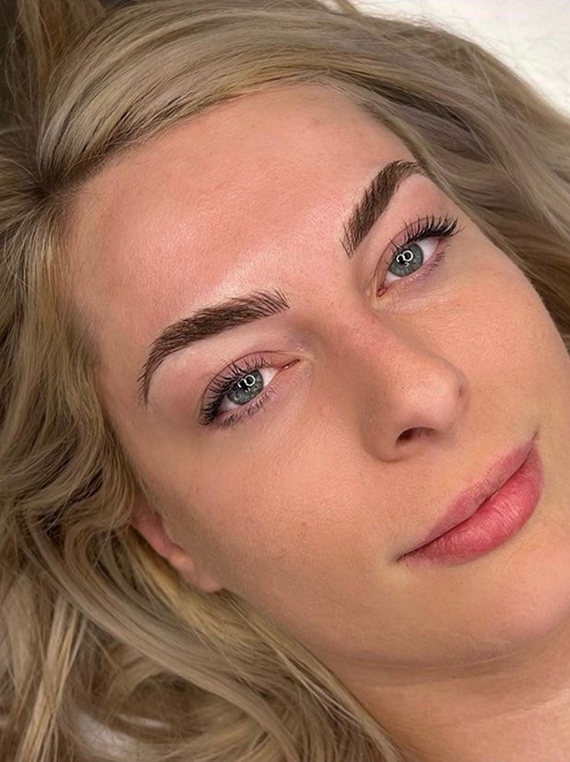 Scalp Micro Pigmentation