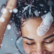Dry, itchy scalp and dandruff treatments in Central Florida